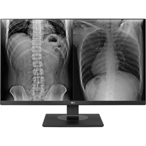 Picture of LG 27HJ713C-B UHD IPS CLINICAL REVIEW MONITOR 27 INCH BLACK